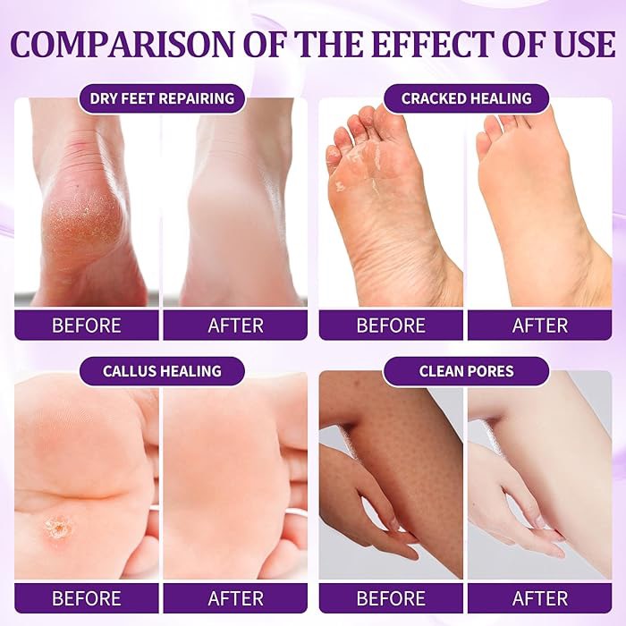 DELUXE PEDICURES 4 STEPS - NBC (BOX OF 50PCS)